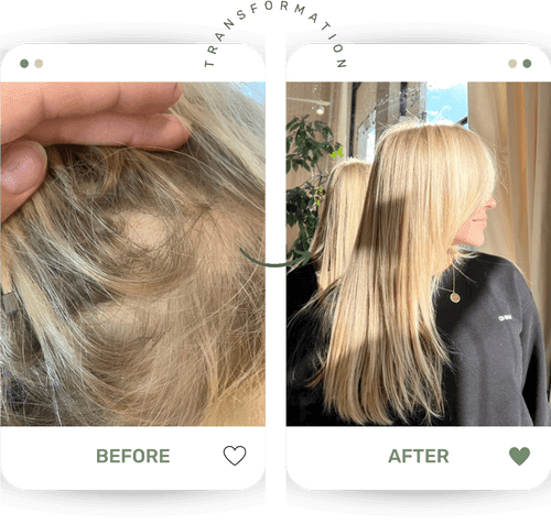 Hair transformation result